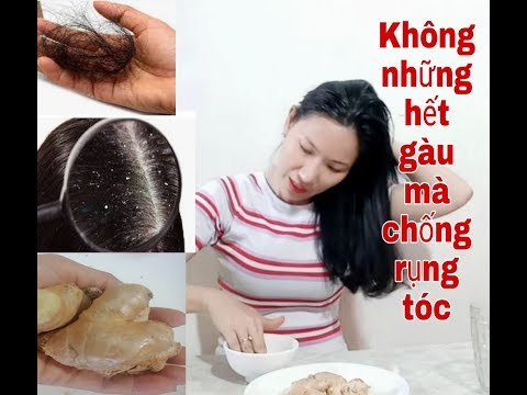 Cách trị gàu chỉ 15 phút Không những hết gàu vinh viễn mà còn hết rụng tóc với gừng