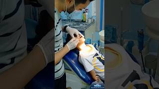 محمود اشطر طفل في عيادة الأسنان || خلع ضروس الأطفال ||no pain extraction teeth pedo #extraction