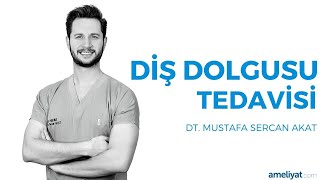 Diş Dolgusu Tedavisi (Dt. Mustafa Sercan Akat)