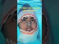 #best #funny #drole #zakiiin0 #shorts