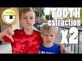 Extractions for Michael AND Chris
