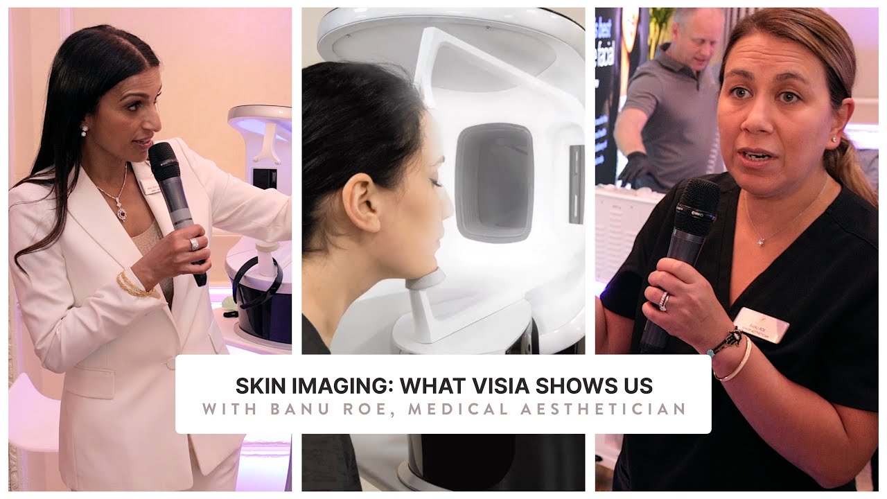 What VISIA Skin Imaging Reveals About Your Skin Health