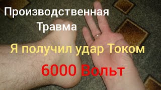 Удар током 6000 Вольт! Производственная травма! Инвалидность!