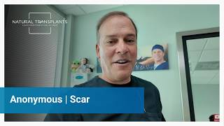 FUT Hair Transplant Scar, What Does It Really Look Like | Dr. Siegel (Anonymous)