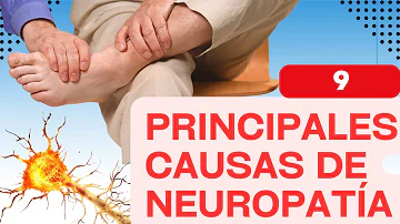 ¿Cuál es la causa principal de la neuropatía?