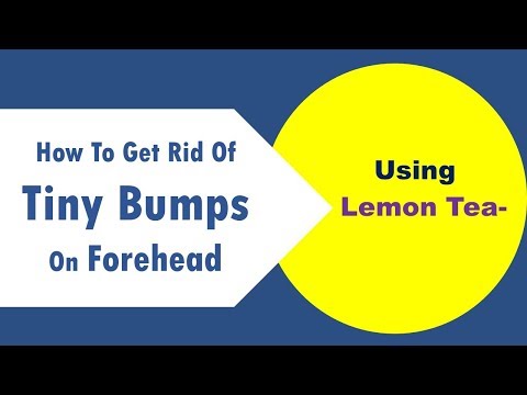 how to get rid of tiny bumps on forehead using Lemon Tea