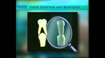 Clip 24: Resorption of Deciduous Molar Associated with Eruption of Premolar