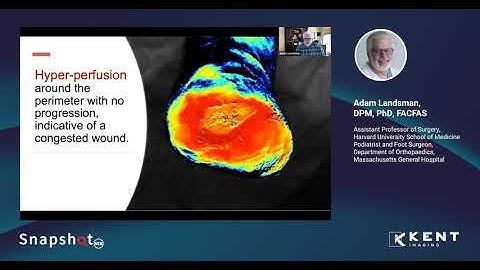 Using NIRS to Visualize the Progression of Wounds Towards Healing: A  Presentation by Dr. A Landsman