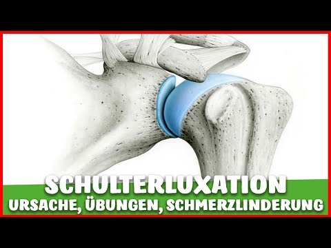 Video: Luxation - Symptome, Erste Hilfe, Ursachen, Typen