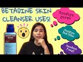 BETADINE SKIN CLEANSER USES! SUPER SULIT!! | Nica Valeza