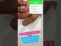 Hand Eczema Hand Skincare Hand Creams Favorite Hand Cream Shorts Youtubeshorts Hand Eczema Hand Skincare Hand Creams Favorite Hand Cream Shorts Youtubeshorts