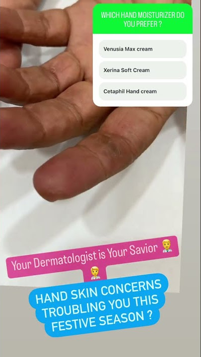 Hand Eczema | hand skincare | hand creams | Favorite hand cream #shorts #youtubeshorts