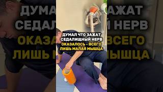 Думал что зажат седалищный нерв оказалось - всего лишь малая мышца