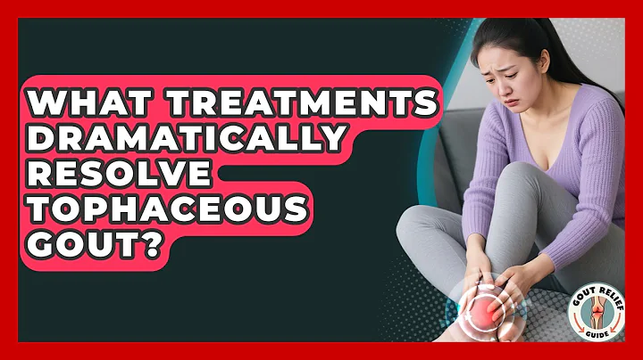 What Treatments Dramatically Resolve Tophaceous Gout? - Gout Relief Guide