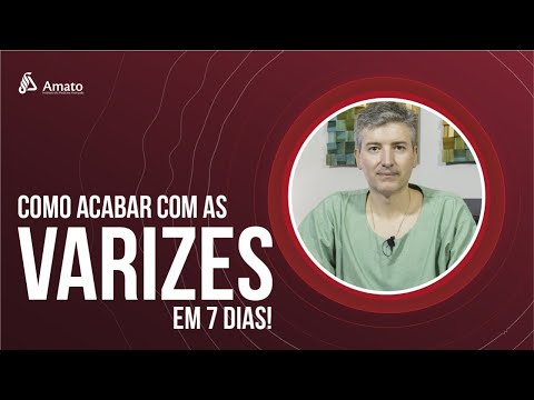 Vídeo: 12 maneiras de se livrar das veias varicosas