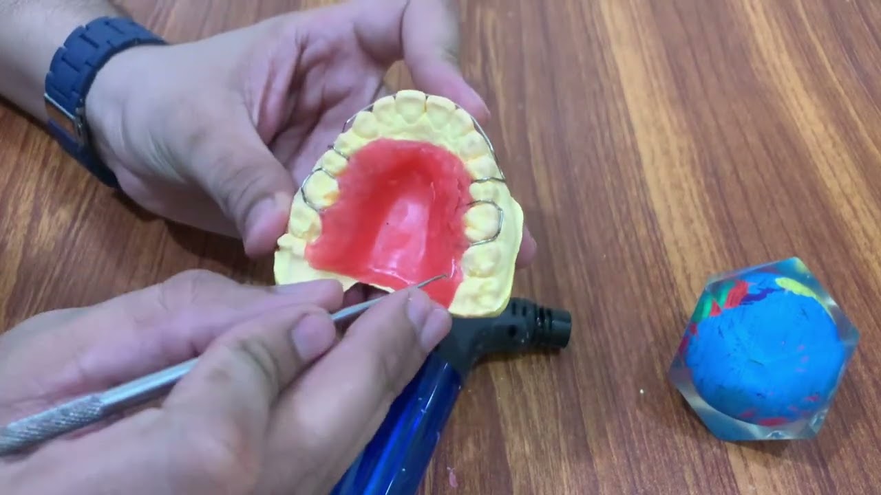 Wax up of ortho appliance 