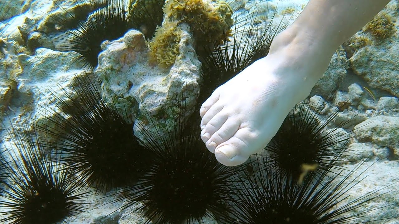 Can A Sea Urchin Kill A Shark?