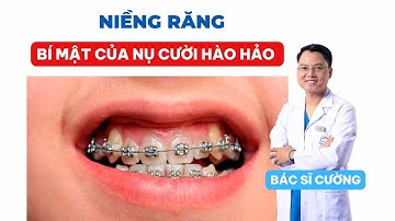 Niềng Răng: Bí Mật Của Nụ Cười Hoàn Hảo - Tất Cả Những Gì Bạn Cần Biết! |Dr Cường Official