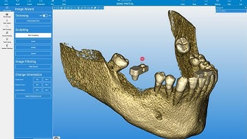 RealGUIDE Software: View of Interest (VOI) Settings