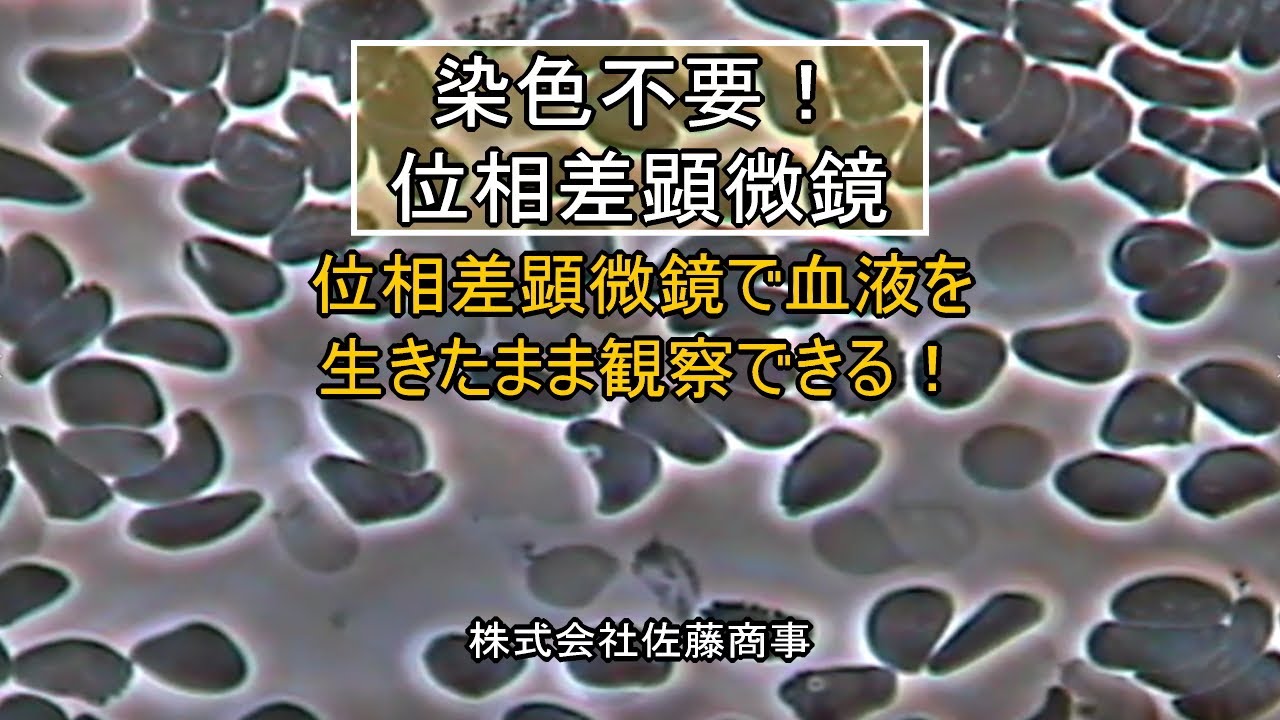 位相差顕微鏡で生きた血液を染色なしで観察できる【株式会社佐藤商事 