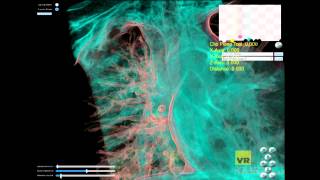 Medical Viewer V 6.8