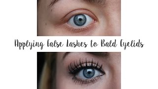 Applying False Lashes to Bald Eyelids (Trichotillomania) | G Beauty screenshot 5