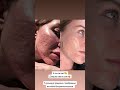 Нужна консультация перед каждым приемом ,так как у всех разные запросы и соответственно протокол