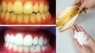 HOW TO USE BANANA PEEL, WHITEN YELLOW TEETH IN ONLY 2 MINUTES