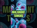 Cancer Tumors Explained in 60 Seconds! #OncologyFacts#CancerTreatment#Cancertumor##CancerAwareness