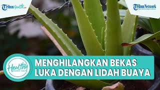 Download lagu Cara Mudah Menghilangkan Bekas Luka dengan Lidah Buaya