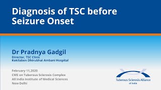 03 Diagnosis of TSC before Seizure Onset