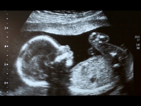 Masturbating Fetus The Latest In The War On Science Women Masturbating Fetus The Latest In The War On Science Women