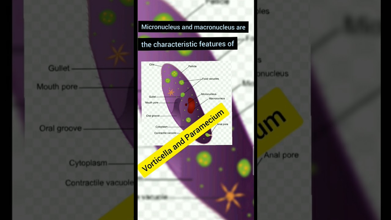 Micronucleus and Macronucleus are the characteristic features of | 