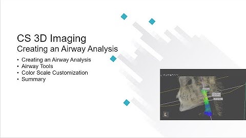 CS 3D Imaging: Creating an Airway Analysis