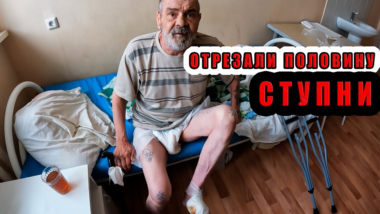 СЕРГЕЙ В БОЛЬНИЦЕ ! ОТРЕЗАЛИ ПАЛЬЦЫ 😱