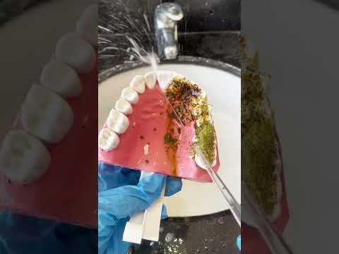 Great Water Flosser For Gum Health Waterflosser Gingivitis