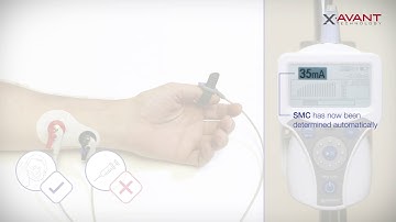 NMT Monitoring using Acceleromyography (AMG)