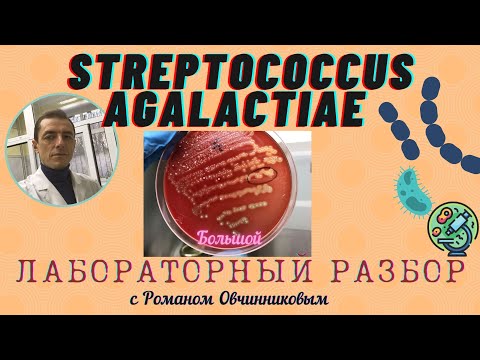 Стретококки группы В (Streptococcus agalactiae) - большой лабораторный разбор с Романом Овчинниковым