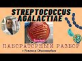 Стретококки группы В (Streptococcus agalactiae) - большой лабораторный разбор с Романом Овчинниковым