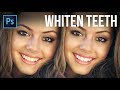 3 Super Realistic Techniques to Whiten Teeth in Photoshop