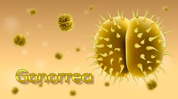 ¿Qué virus causa la gonorrea?