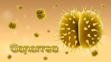 ¿Qué pruebas confirman la gonorrea?