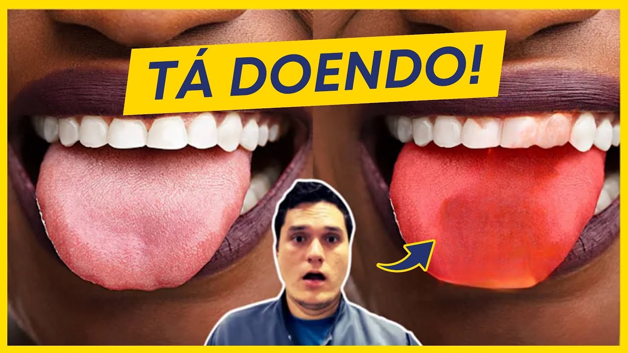 LÍNGUA DOENDO - O QUE PODE SER? - YouTube