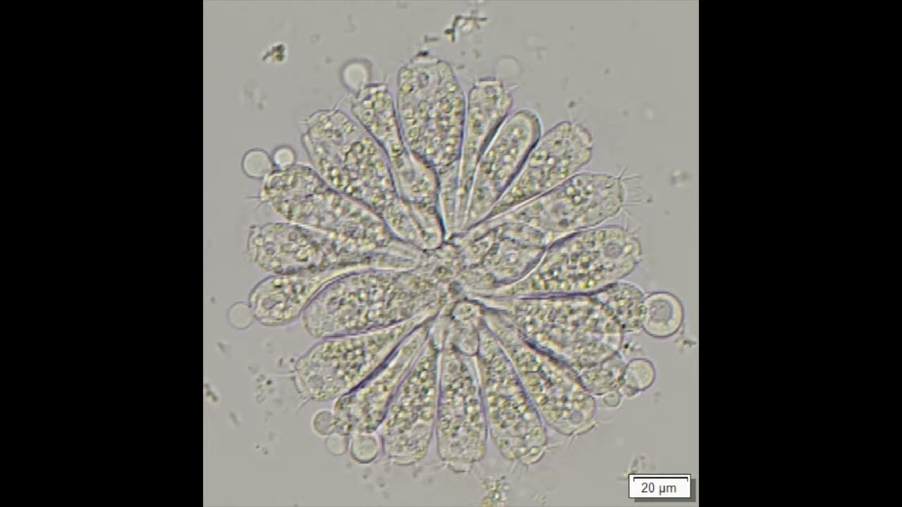 Ciliate - Opercularia peritrich colony - compost microbe