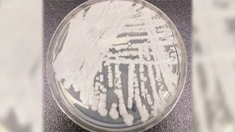 CDC warns about drug-resistant superbug