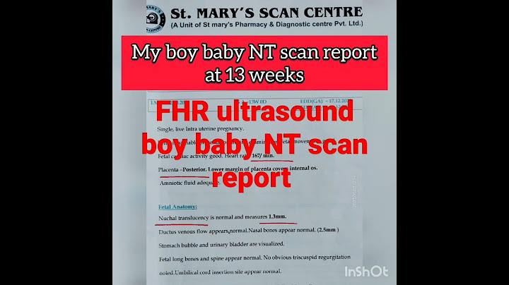 Ultrasound NT scan report boy baby at 13 weeks #shorts #boybaby #genderreveal #ultrasound
