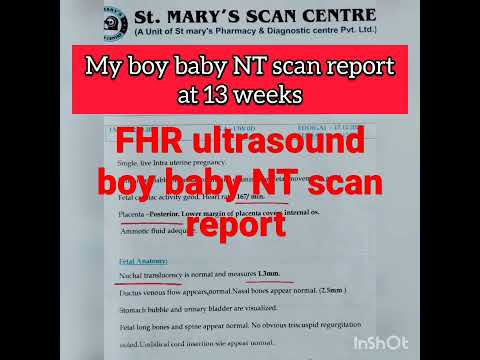 Ultrasound NT scan