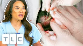 Dr. Lee Gets Splashed With Cyst Juice! | Dr Pimple Popper | UNCENSORED