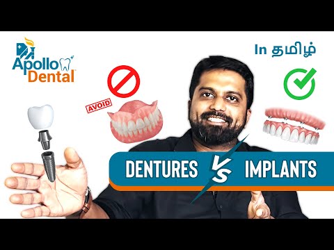 Dentures vs Implants
