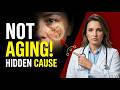 Doctor Warns These “Age Spots” Are NOT Aging – 5 Hidden Causes You’re Ignoring